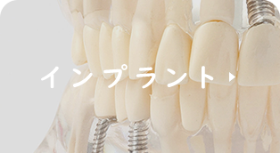 インプラント